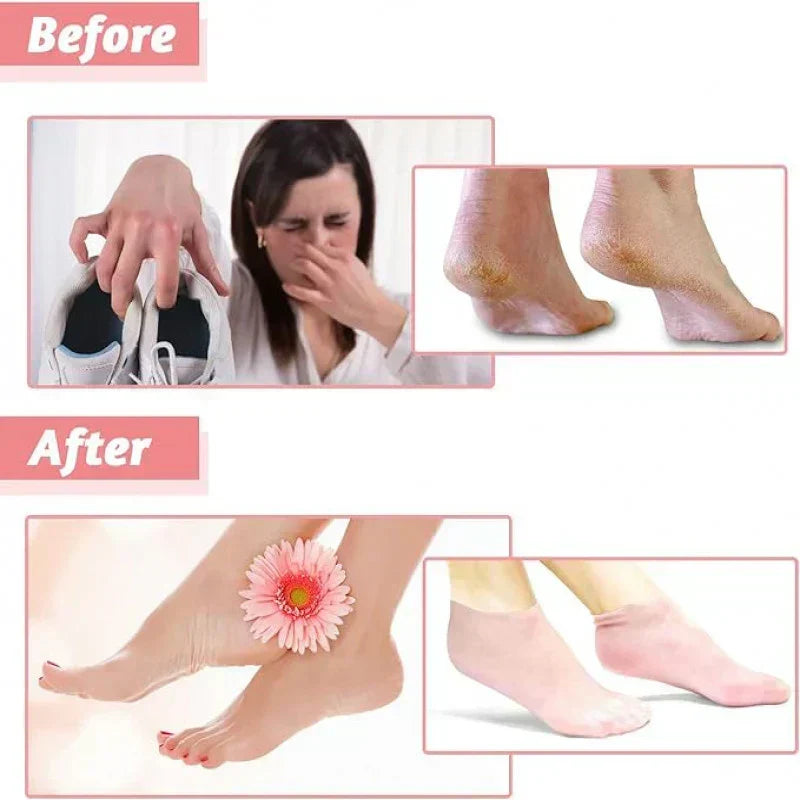 Anti Crack Silicone Socks